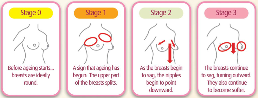 how-breasts-age